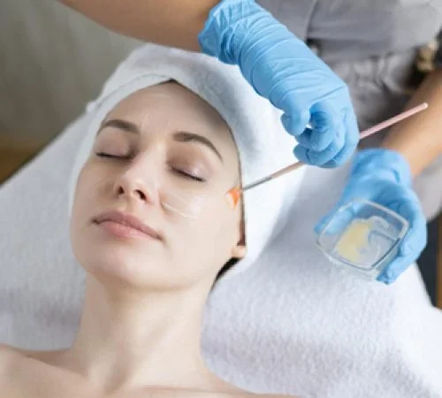 derma-peeling