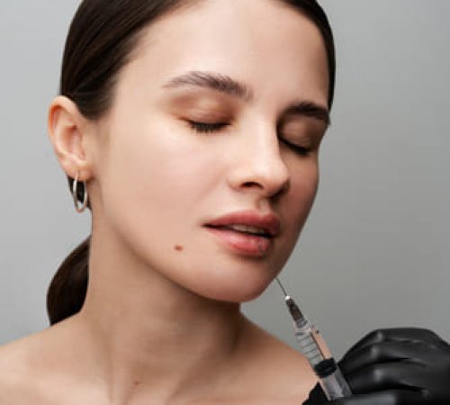 lip-filler
