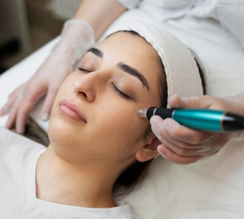 micro-needling